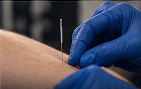 Técnicas de fisioterapia invasiva