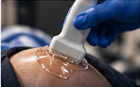Ecografía musculoesquelética